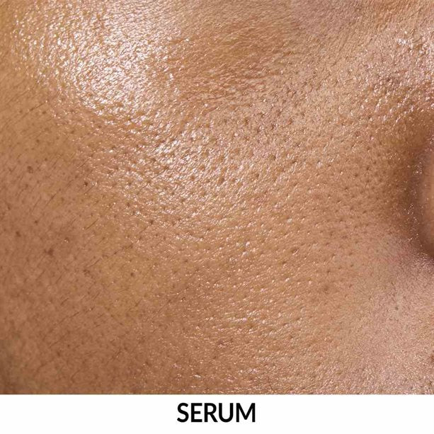 Anew Multipeptit Yağlanma Karşıtı + Nemlendirici Serum 30ml