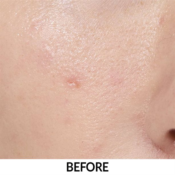 Anew Multipeptit Yağlanma Karşıtı + Nemlendirici Serum 30ml