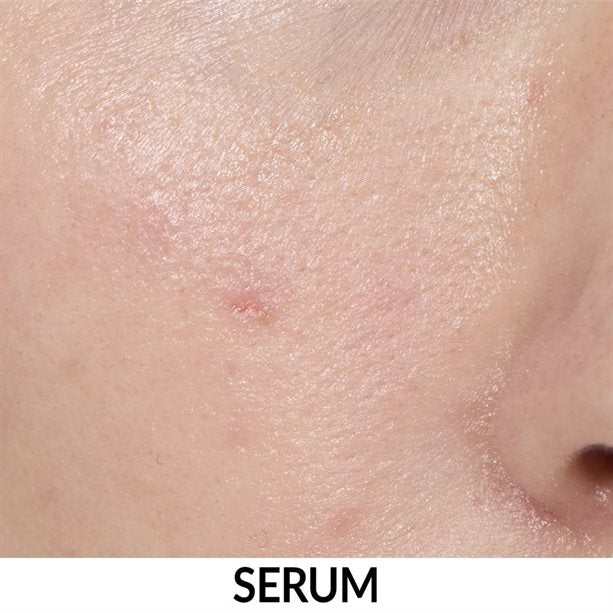 Anew Multipeptit Yağlanma Karşıtı + Nemlendirici Serum 30ml
