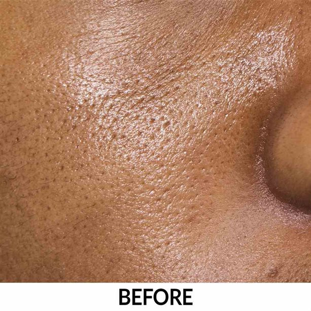 Anew Multipeptit Yağlanma Karşıtı + Nemlendirici Serum 30ml