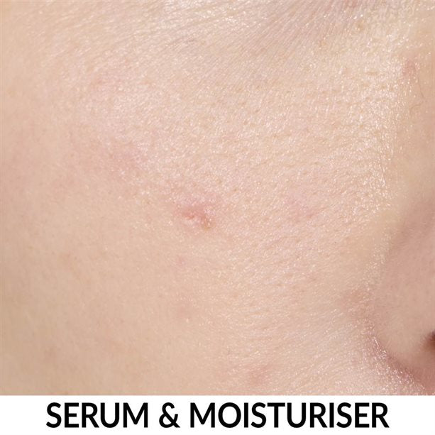 Anew Multipeptit Yağlanma Karşıtı + Nemlendirici Serum 30ml
