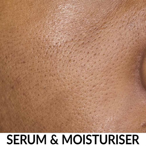 Anew Multipeptit Yağlanma Karşıtı + Nemlendirici Serum 30ml