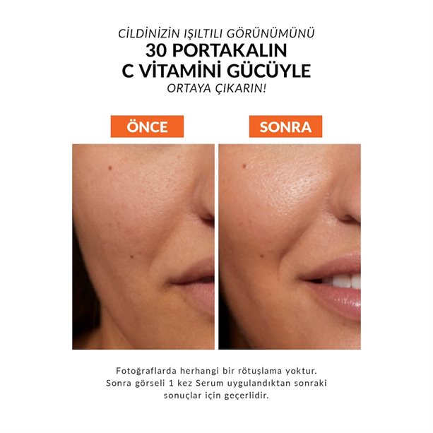 Anew Vitamin C Canlandırıcı Serum 30ml